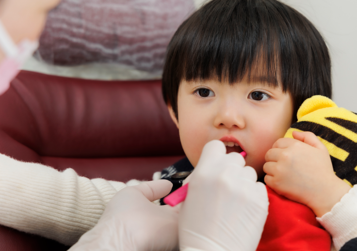 ブラッシング指導