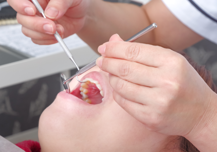 お口の状態チェック