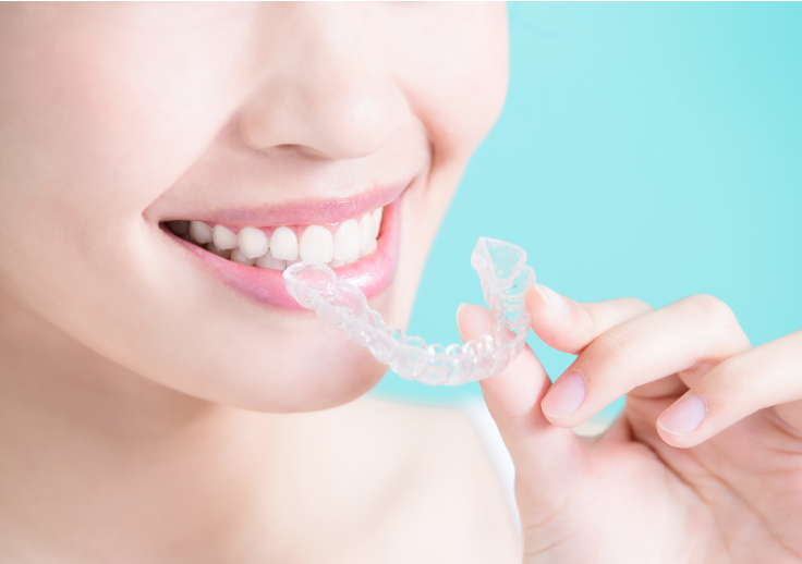 マウスピース矯正（インビザライン）