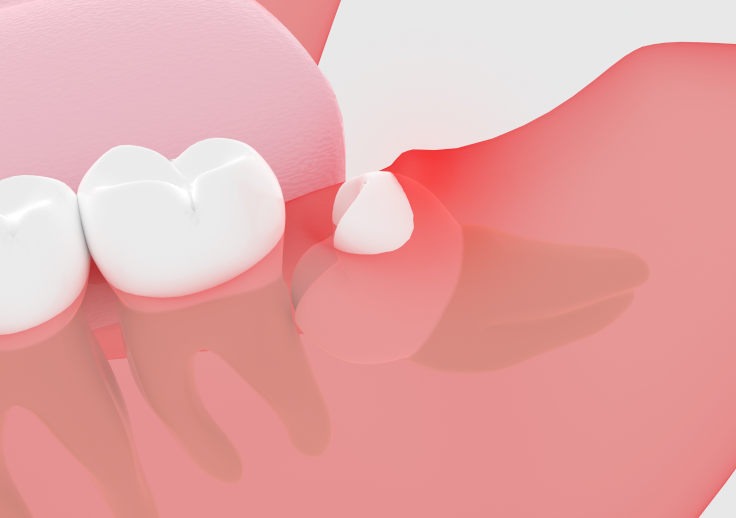 難しい症例にも対応