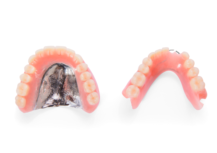 金属床デンチャー