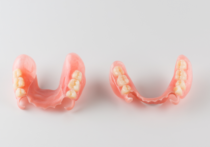 ノンクラスプデンチャー