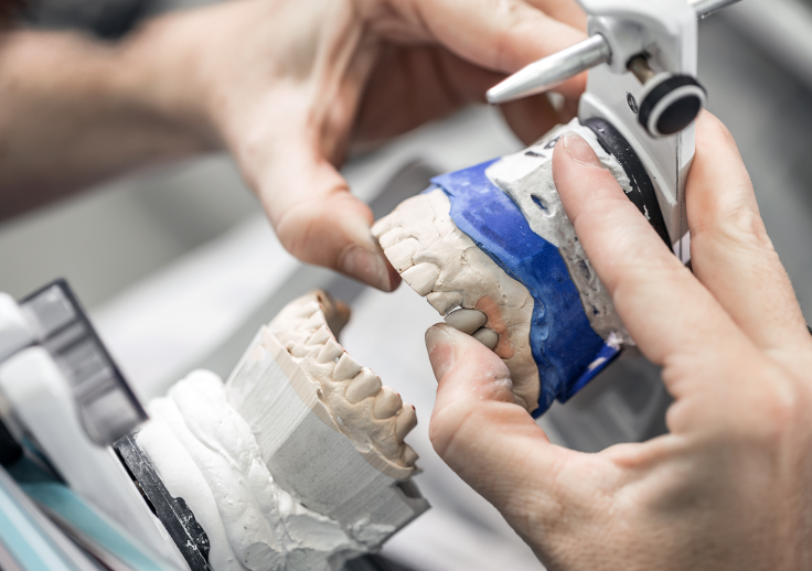 精密検査・型取り