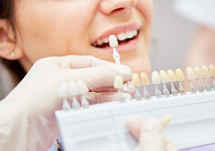 ホワイトニング治療の流れを知ろう！