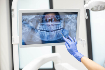  治療計画のご説明